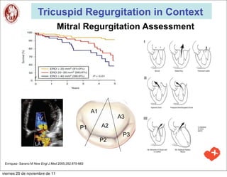 Tricuspid Regurgitation in Context
                                  Mitral Regurgitation Assessment




                                                      A1
                                                                A3
                                                P1         A2
                                                                 P3
                                                           P2



 Enriquez- Sarano M New Engl J Med 2005;352:875-883


viernes 25 de noviembre de 11
 