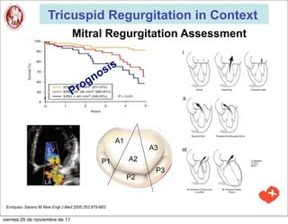 Tricuspid Regurgitation in Context
                                  Mitral Regurgitation Assessment

                                            is
                                         os
                                      ogn
                                 Pr



                                                      A1
                                                                A3
                                                P1         A2
                                                                 P3
                                                           P2



 Enriquez- Sarano M New Engl J Med 2005;352:875-883


viernes 25 de noviembre de 11
 