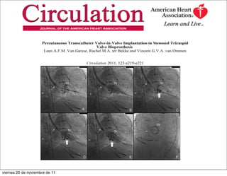 viernes 25 de noviembre de 11
 