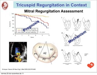 Tricuspid Regurgitation in Context
                                  Mitral Regurgitation Assessment

                                            is
                                         os
                                      ogn
                                 Pr
                                                                               ism
                                                                             an
                                                                           ch
                                                                      Me
                                                      A1
                                                                A3
                                                P1         A2
                                                                 P3
                                                           P2



 Enriquez- Sarano M New Engl J Med 2005;352:875-883


viernes 25 de noviembre de 11
 