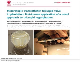 European Heart Journal (2011) 32, 1207–1213

viernes 25 de noviembre de 11
 