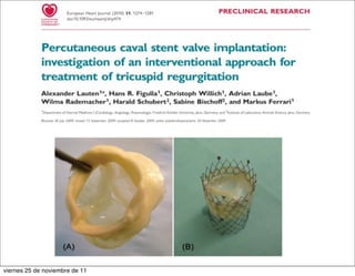 viernes 25 de noviembre de 11
 