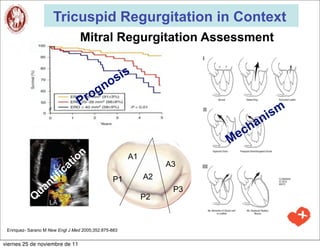 Tricuspid Regurgitation in Context
                                   Mitral Regurgitation Assessment

                                              is
                                           os
                                        ogn
                                  Pr
                                                                               ism
                                                                             an
                                                                           ch
                                                                      Me
                                 tion                 A1
                             a                                  A3
                       if ic                               A2
                 nt                             P1
              ua                                                 P3
             Q                                             P2



 Enriquez- Sarano M New Engl J Med 2005;352:875-883


viernes 25 de noviembre de 11
 