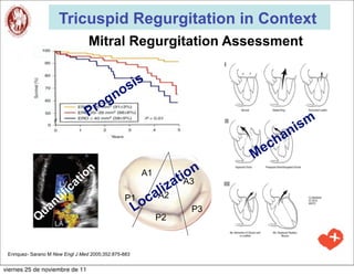 Tricuspid Regurgitation in Context
                                   Mitral Regurgitation Assessment

                                              is
                                           os
                                        ogn
                                  Pr
                                                                                    ism
                                                                                  an
                                                                                ch
                                                                           Me
                                 tion                  A1
                                                                 a  iA3n
                                                                   to
                             a
                       if ic                                 liz
                                                            aA2
                 nt                             P1
                                                      Loc
              ua                                                     P3
             Q                                              P2



 Enriquez- Sarano M New Engl J Med 2005;352:875-883


viernes 25 de noviembre de 11
 