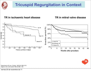 Tricuspid Regurgitation in Context


     TR in ischaemic heart disease              TR in mitral valve disease




Fleischmann KF Am J Cardiol 1997;80:1266-1272
Sagie A J Am Coll Cardiol 1994;24:696 –702

viernes 25 de noviembre de 11
 