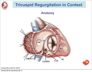 Tricuspid Regurgitation in Context
                                    Anatomy




Postgrad Med J 2009 85: 546-551

viernes 25 de noviembre de 11
 