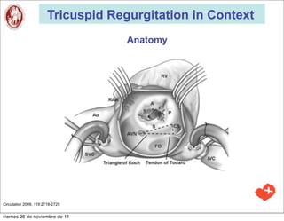 Tricuspid Regurgitation in Context
                                     Anatomy




Circulation 2009, 119:2718-2725


viernes 25 de noviembre de 11
 