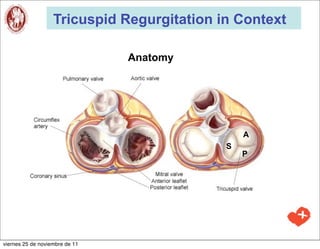 Tricuspid Regurgitation in Context

                                Anatomy




                                                A
                                            S
                                                P




viernes 25 de noviembre de 11
 
