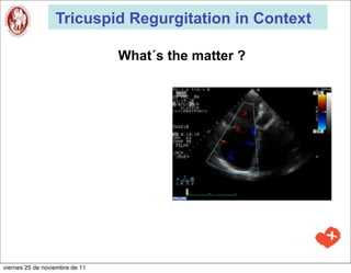 Tricuspid Regurgitation in Context

                                What´s the matter ?




viernes 25 de noviembre de 11
 