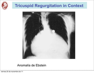 Tricuspid Regurgitation in Context




                     Anomalía de Ebstein
viernes 25 de noviembre de 11
 