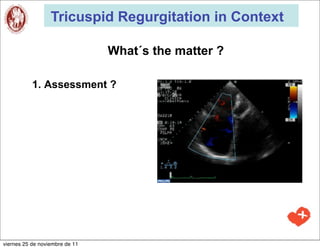 Tricuspid Regurgitation in Context

                                What´s the matter ?

           1. Assessment ?




viernes 25 de noviembre de 11
 