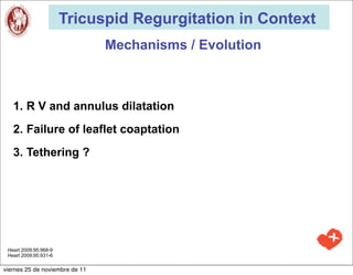 Tricuspid Regurgitation in Context
                                Mechanisms / Evolution



   1. R V and annulus dilatation
   2. Failure of leaflet coaptation
   3. Tethering ?




 Heart 2009;95;968-9
 Heart 2009;95:931-6

viernes 25 de noviembre de 11
 