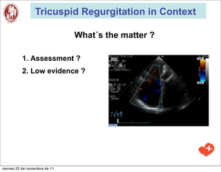Tricuspid Regurgitation in Context

                                What´s the matter ?

           1. Assessment ?
           2. Low evidence ?




viernes 25 de noviembre de 11
 