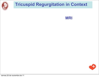 Tricuspid Regurgitation in Context


                                        MRI




viernes 25 de noviembre de 11
 