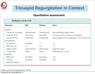 Tricuspid Regurgitation in Context
                                                       Quantitative assessment




European Journal of Echocardiography 2010;11:307–332

viernes 25 de noviembre de 11
 