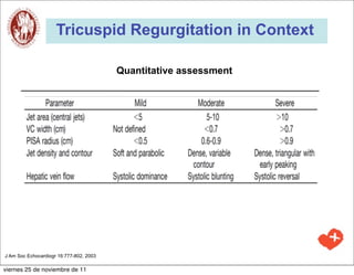 Tricuspid Regurgitation in Context

                                         Quantitative assessment




J Am Soc Echocardiogr 16:777-802, 2003

viernes 25 de noviembre de 11
 