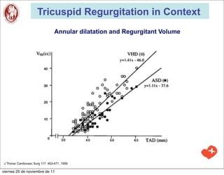 Tricuspid Regurgitation in Context
                                   Annular dilatation and Regurgitant Volume




 J Thorac Cardiovasc Surg 117: 463-471, 1999

viernes 25 de noviembre de 11
 