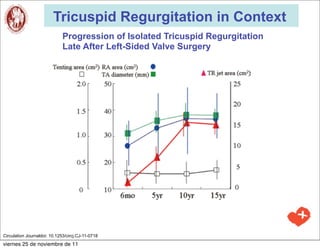 Tricuspid Regurgitation in Context
                              Progression of Isolated Tricuspid Regurgitation
                              Late After Left-Sided Valve Surgery




Circulation Journaldoi: 10.1253/circj.CJ-11-0718
viernes 25 de noviembre de 11
 
