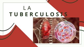 la tuberculosis TEMA A TRATAR PARA EXPOSICION | PPTX