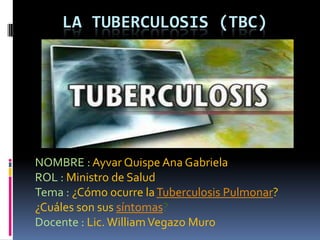 LA TUBERCULOSIS (TBC)




NOMBRE : Ayvar Quispe Ana Gabriela
ROL : Ministro de Salud
Tema : ¿Cómo ocurre la Tuberculosis Pulmonar?
¿Cuáles son sus síntomas?
Docente : Lic. William Vegazo Muro
 