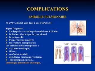 EXAMENS COMPLEMENTAIRESECHO-DOPPLER VEINEUXLes types de TVP des MI:-Distales ou surales: (donnant rarement des EP) touchant lesveines: tibiales (antérieures, postérieures), péronières,soléaires, gémellaires.-Proximales: (pouvant donner une EP) touchant les veinespoplités, fémorales (superficielles, profondes ou communes) iliaques (internes ou externes) , VCI.Contrôles: à j+15, j+45 ,j+3 mois j+6 mois.. 