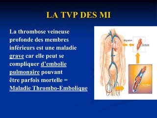 LA TVP DES MILa thrombose veineuse profonde des membres inférieurs est une maladie grave car elle peut se compliquer d’emboliepulmonaire pouvant être parfois mortelle = Maladie Thrombo-Embolique