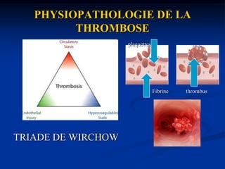 TRAITEMENTDUREE SELON HASHBPM ou FONDAPARINUX: 3 à6 j.AVK :3, 6 ou 12 mois selon le siège du thrombus minimum. Cause réversible-TVP distale: 3 mois-TVP proximale ou EP : 6 à 12 mois.Pas de cause précise -Premier épisode*TVP distale: 3 mois*TVP proximale ou EP idiopathique :6 à 12 mois -Récidive TVP/EP sans cause :traitement au long cours*Cancer : HBPM 6 à 12 mois puis AVK/HBPM long cours jusqu’à laGuérison (progrmanne SOR)*troubles de l’hémostase: cas par cas.