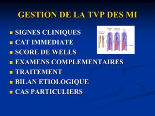 GESTION DE LA TVP DES MISIGNES CLINIQUESCAT IMMEDIATESCORE DE WELLSEXAMENS COMPLEMENTAIRESTRAITEMENTBILAN ETIOLOGIQUECAS PARTICULIERS