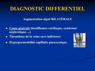 FACTEURS TRANSITOIRESChirurgie : -Orthopédique: arthroscopie du genou-Abdominale lourde, générale-NeurochirurgieTraumatologie: fractures, contusions, entorses ,plâtre des membres inférieursObstétrique : - Grossesse- Accouchement- Césarienne- Post-partum-Avortement