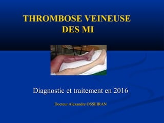 THROMBOSE VEINEUSE
DES MI
Diagnostic et traitement en 2016Diagnostic et traitement en 2016
Docteur Alexandre OSSEIRANDocteur Alexandre OSSEIRAN
 