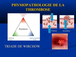 PHYSIOPATHOLOGIE DE LAPHYSIOPATHOLOGIE DE LA
THROMBOSETHROMBOSE
TRIADE DE WIRCHOWTRIADE DE WIRCHOW
thrombusthrombusFibrineFibrine
plaquettesplaquettes
 