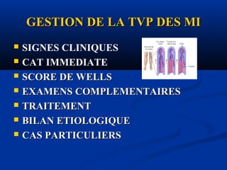 GESTION DE LA TVP DES MIGESTION DE LA TVP DES MI
 SIGNES CLINIQUES
 CAT IMMEDIATE
 SCORE DE WELLSSCORE DE WELLS
 EXAMENS COMPLEMENTAIRESEXAMENS COMPLEMENTAIRES
 TRAITEMENTTRAITEMENT
 BILAN ETIOLOGIQUEBILAN ETIOLOGIQUE
 CAS PARTICULIERSCAS PARTICULIERS
 