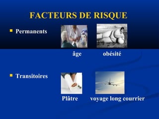 FACTEURS DE RISQUE
 Permanents
âge obésité
 Transitoires
Plâtre voyage long courrier
 