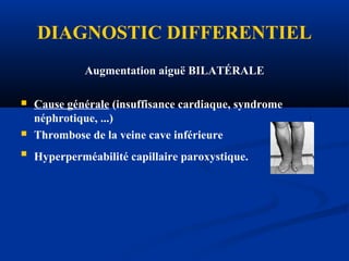 DIAGNOSTIC DIFFERENTIEL
Augmentation aiguë BILATÉRALE
 Cause générale (insuffisance cardiaque, syndrome
néphrotique, ...)
 Thrombose de la veine cave inférieure
 Hyperperméabilité capillaire paroxystique.
 