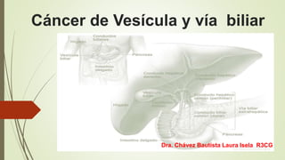 Cáncer de Vesícula y vía biliar
Dra. Chávez Bautista Laura Isela R3CG
 