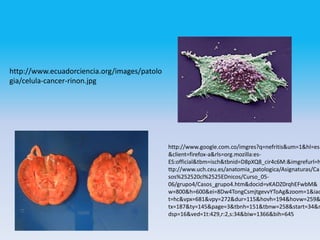 http://www.ecuadorciencia.org/images/patolo
gia/celula-cancer-rinon.jpg




                                              http://www.google.com.co/imgres?q=nefritis&um=1&hl=es
                                              &client=firefox-a&rls=org.mozilla:es-
                                              ES:official&tbm=isch&tbnid=D8pXQ8_cir4c6M:&imgrefurl=h
                                              ttp://www.uch.ceu.es/anatomia_patologica/Asignaturas/Ca
                                              sos%252520cl%2525EDnicos/Curso_05-
                                              06/grupo4/Casos_grupo4.htm&docid=vKADZ0rqhEFwbM&
                                              w=800&h=600&ei=8Dw4TongCsmjtgevvYToAg&zoom=1&iac
                                              t=hc&vpx=681&vpy=272&dur=115&hovh=194&hovw=259&
                                              tx=187&ty=145&page=3&tbnh=151&tbnw=258&start=34&n
                                              dsp=16&ved=1t:429,r:2,s:34&biw=1366&bih=645
 