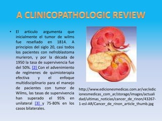 •   El articulo argumenta que
    inicialmente el tumor de wilms
    fue reseñado en 1814. A
    principios del siglo 20, casi todos
    los pacientes con nefroblastoma
    murieron, y por la década de
    1950 la tasa de supervivencia fue
    del 50%. [2] Con el advenimiento
    de regímenes de quimioterapia
    efectiva     y      el     enfoque
    multidisciplinario para el manejo
    de pacientes con tumor de             http://www.edicionesmedicas.com.ar/var/edic
    Wilms, las tasas de supervivencia     ionesmedicas_com_ar/storage/images/actuali
    han superado el 95% en                dad/ultimas_noticias/cancer_de_rinon/43267-
    unilateral [3] y 75-80% en los        1-esl-AR/Cancer_de_rinon_article_thumb.jpg
    casos bilaterales.
 