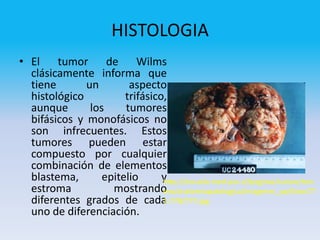 HISTOLOGIA
• El tumor de Wilms
  clásicamente informa que
  tiene       un        aspecto
  histológico          trifásico,
  aunque       los     tumores
  bifásicos y monofásicos no
  son infrecuentes. Estos
  tumores pueden estar
  compuesto por cualquier
  combinación de elementos
  blastema,       epitelio      y
                                http://escuela.med.puc.cl/paginas/cursos/terc
  estroma           mostrando   ero/anatomiapatologica/imagenes_ap/fotos77
  diferentes grados de cada     1-778/777.jpg
  uno de diferenciación.
 