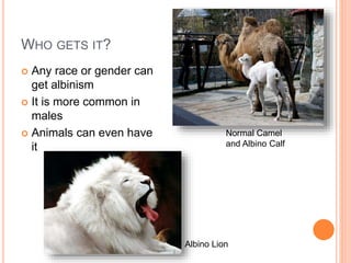 WHO GETS IT?
 Any race or gender can
get albinism
 It is more common in
males
 Animals can even have
it
Albino Lion
Normal Camel
and Albino Calf
 