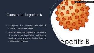 • A hepatite B é causada pelo vírus B
(chamado também de HBV).
• Uma vez dentro do organismo humano, o
vírus ataca os hepatócitos (células do
fígado) e começa a se multiplicar, levando
à inflamação do órgão.
Causas da hepatite B
Fig.37- Vírus da hepatite B
 