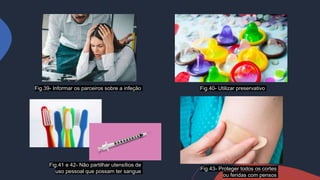 Fig.39- Informar os parceiros sobre a infeção
Fig.41 e 42- Não partilhar utensílios de
uso pessoal que possam ter sangue
Fig.40- Utilizar preservativo
Fig.43- Proteger todos os cortes
ou feridas com pensos
 
