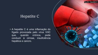 • A hepatite C é uma inflamação do
fígado provocada pelo vírus VHC
que, quando crónica, pode
conduzir à cirrose, insuficiência
hepática e cancro.
Hepatite C
Fig.45- Hepatite C
 