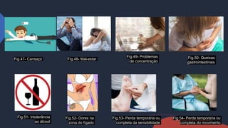 Fig.47- Cansaço
Fig.51- Intolerância
ao álcool
Fig.49- Problemas
de concentração
Fig.48- Mal-estar Fig.50- Queixas
gastrointestinais
Fig.53- Perda temporária ou
completa da sensibilidade
Fig.52- Dores na
zona do fígado
Fig.54- Perda temporária ou
completa do movimento
 