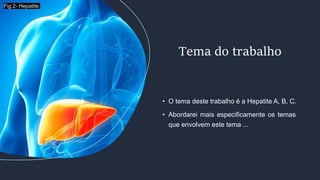 • O tema deste trabalho é a Hepatite A, B, C.
• Abordarei mais especificamente os temas
que envolvem este tema ...
Tema do trabalho
Fig.2- Hepatite
 