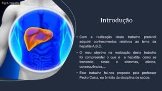 • Com a realização deste trabalho pretendi
adquirir conhecimentos relativos ao tema da
hepatite A,B,C.
• O meu objetivo na realização deste trabalho
foi compreender o que é a hepatite, como se
transmite, sinais e sintomas, efeitos,
consequências,...
• Este trabalho foi-nos proposto pela professor
Pedro Costa, no âmbito da disciplina de saúde.
Introdução
Fig.3- Hepatite
 