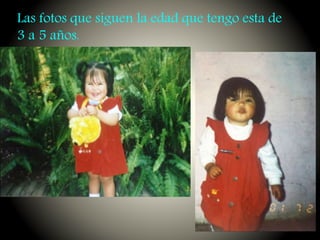 Las fotos que siguen la edad que tengo esta de
3 a 5 años.
 