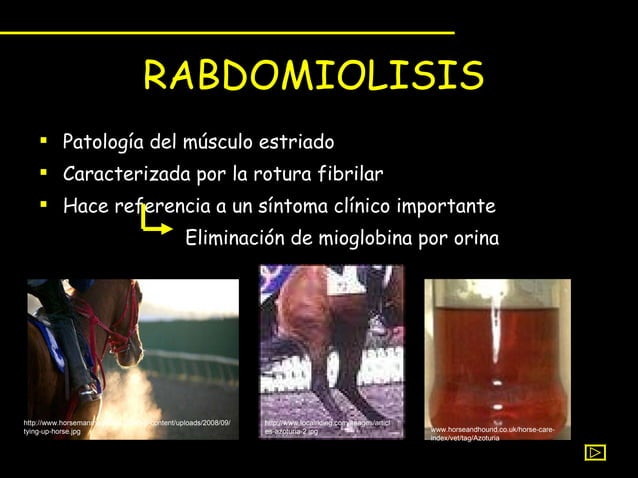 Rabdomiolisis