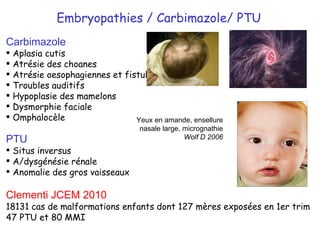 Embryopathies / Carbimazole/ PTU Carbimazole   Aplasia cutis Atrésie des choanes Atrésie oesophagiennes et fistules Troubles auditifs Hypoplasie des mamelons Dysmorphie faciale Omphalocèle PTU  Situs inversus A/dysgénésie rénale Anomalie des gros vaisseaux Clementi JCEM 2010 18131 cas de malformations enfants dont 127 mères exposées en 1er trim 47 PTU et 80 MMI Yeux en amande, ensellure nasale large, micrognathie Wolf D 2006 