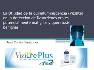 La Utilidad de la quimiluminiscencia (Vizilite)
en la detección de Desórdenes orales
potencialmente malignos y queratosis
benignas

Juan Cortés Fernández

 