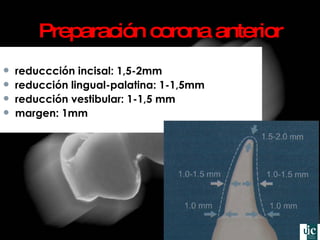 Preparación corona anterior reduccción incisal: 1,5 -2mm reducción lingual-palatina: 1-1,5mm reducción vestibular: 1-1,5 mm margen: 1mm 